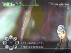 Screenshots de Trauma Center : Second Opinion sur Wii